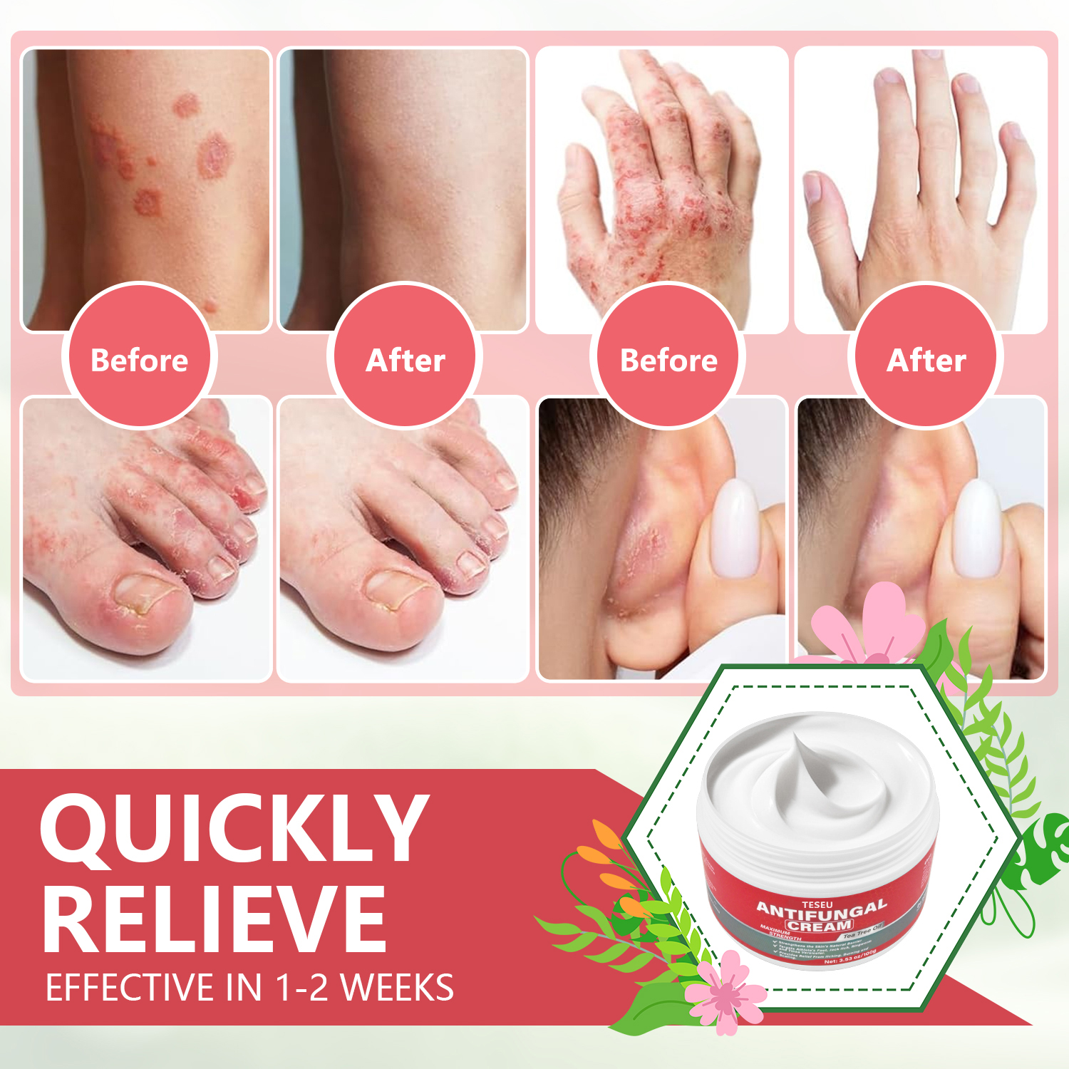 TESEU Antifungal Cream Strengthens Skin Natural Barrier, 3.53oz - Image 2