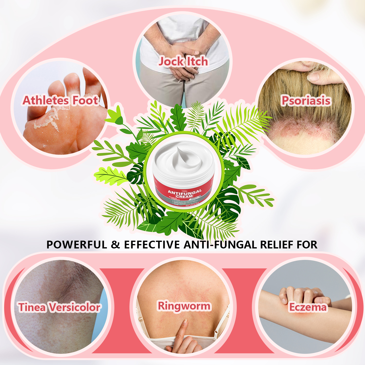 TESEU Antifungal Cream Strengthens Skin Natural Barrier, 3.53oz - Image 3