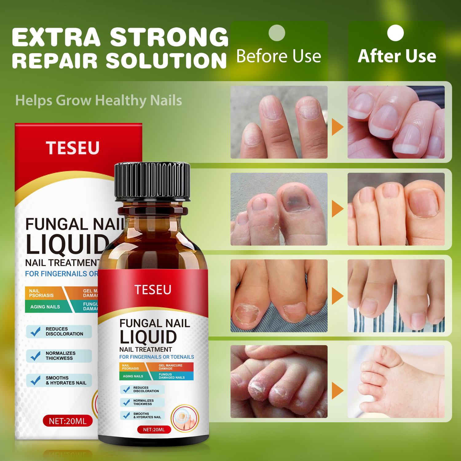 TESEU Fungal Nail Liquid Extra Strong Treatment for Toenails - Image 5