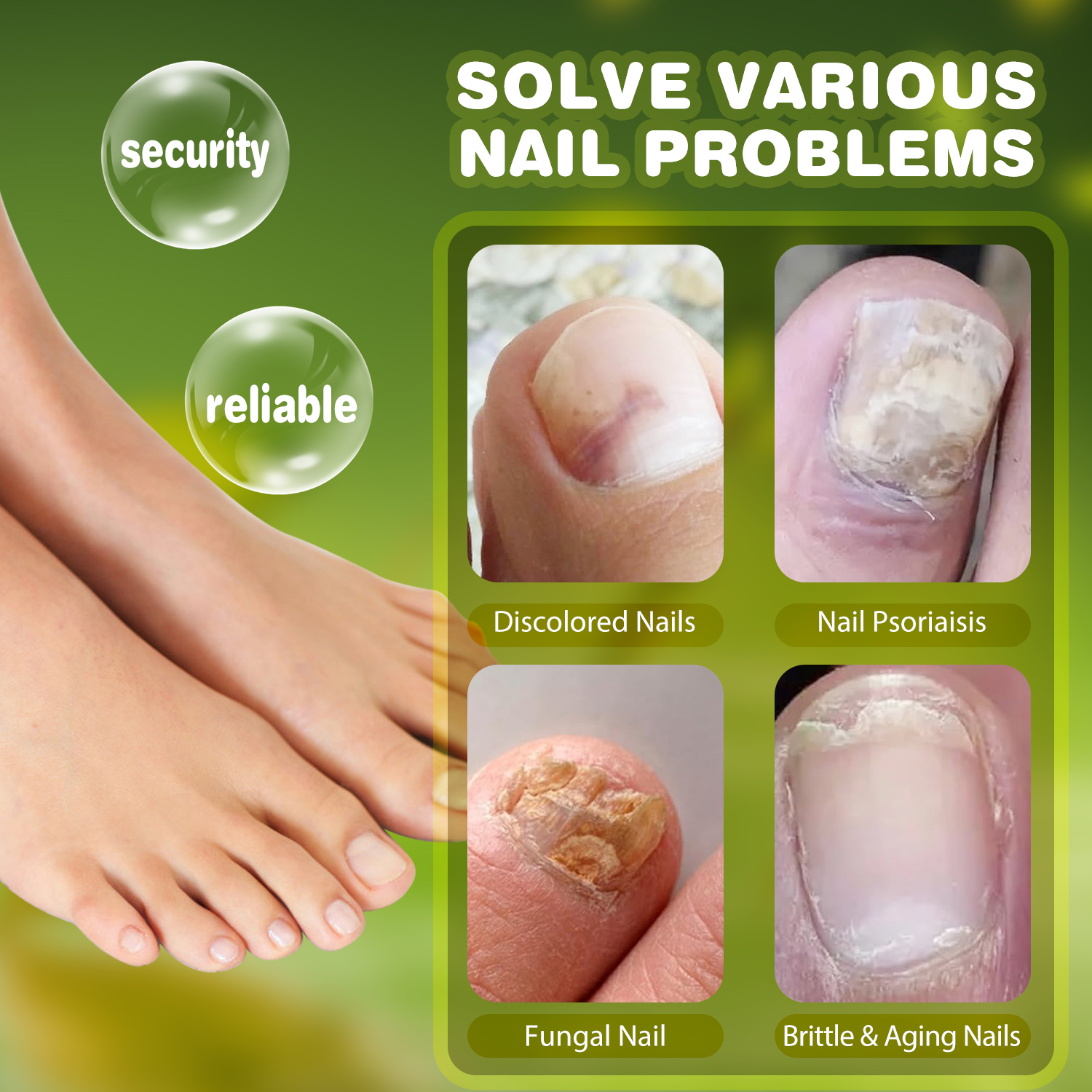 TESEU Fungal Nail Liquid Extra Strong Treatment for Toenails - Image 6