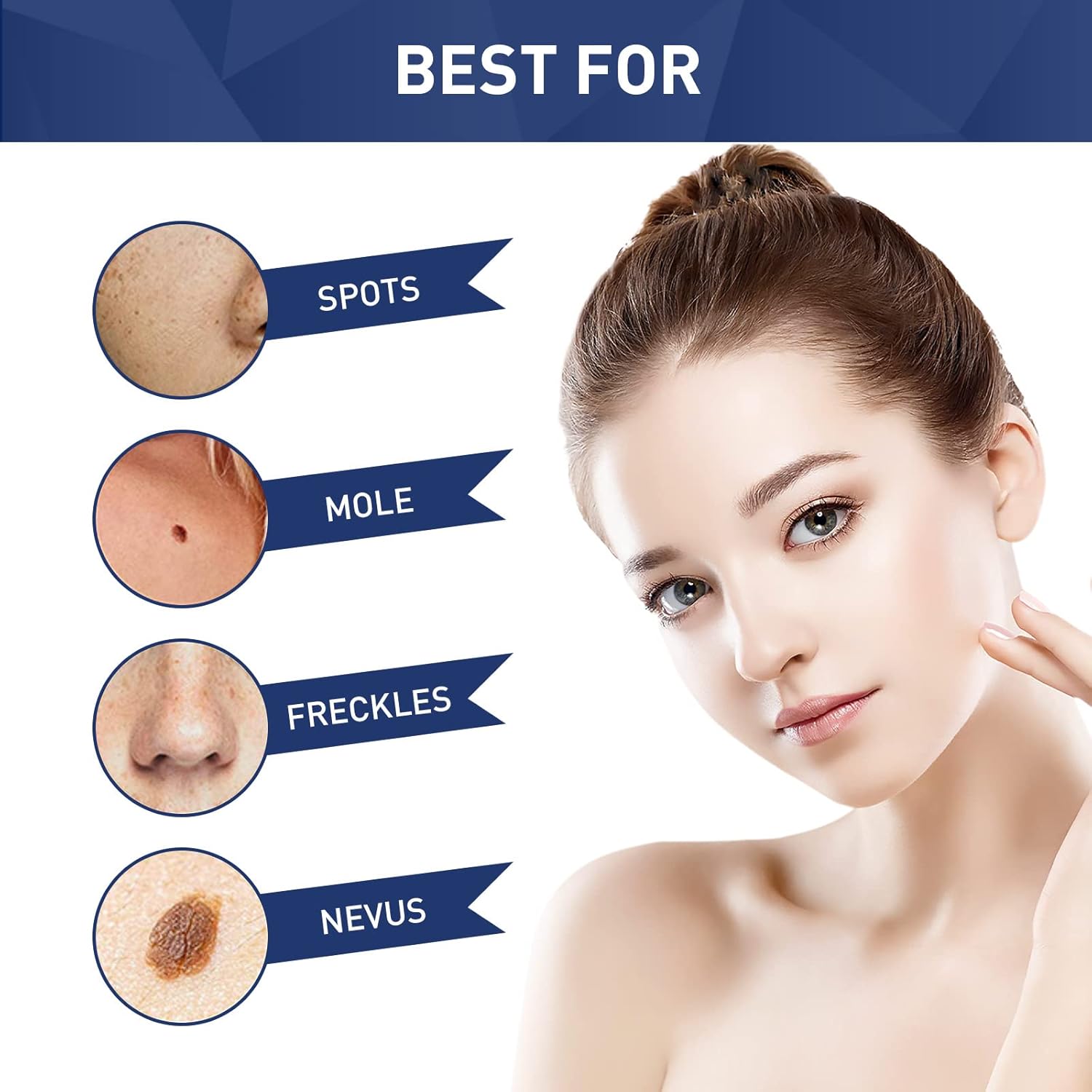 Infographic for TESEU wart remover, showing treatable skin concerns: plantar wart, calluses, verruca
