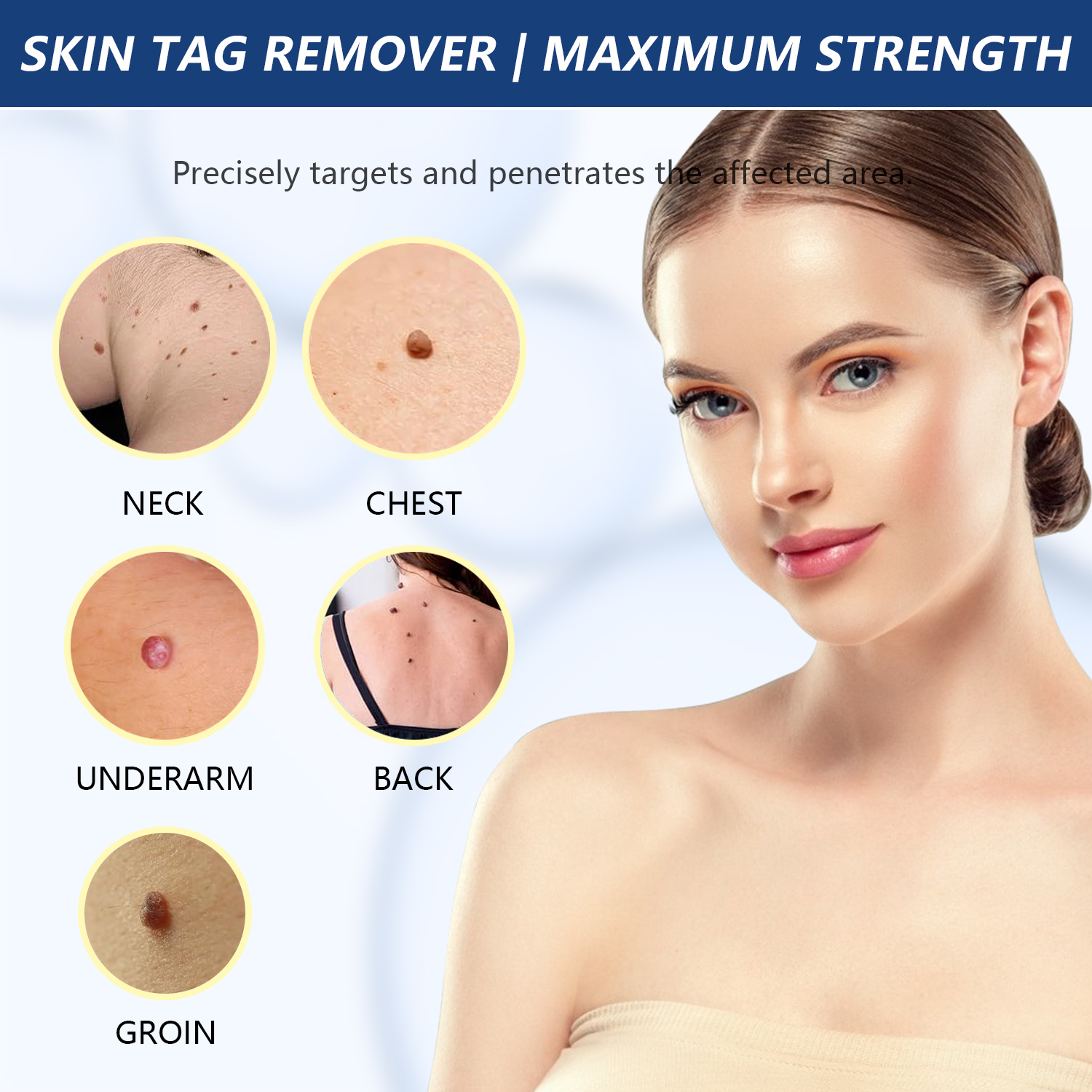 Effective TESEU skin tag remover graphic, labelled close-ups of tags on neck, chest, armpit, back and groin skin