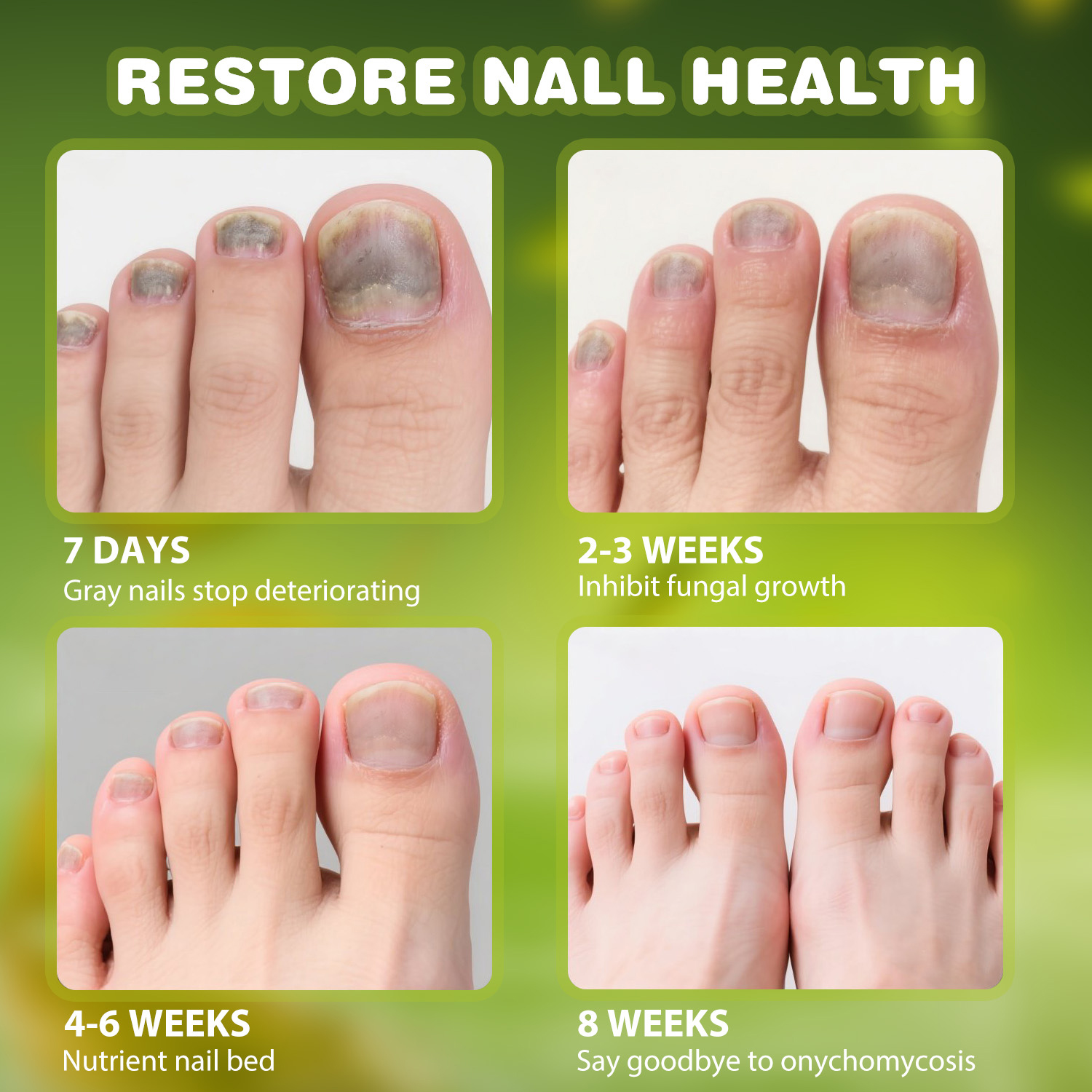 TESEU Fungal Nail Liquid Extra Strong Treatment for Toenails - Image 8