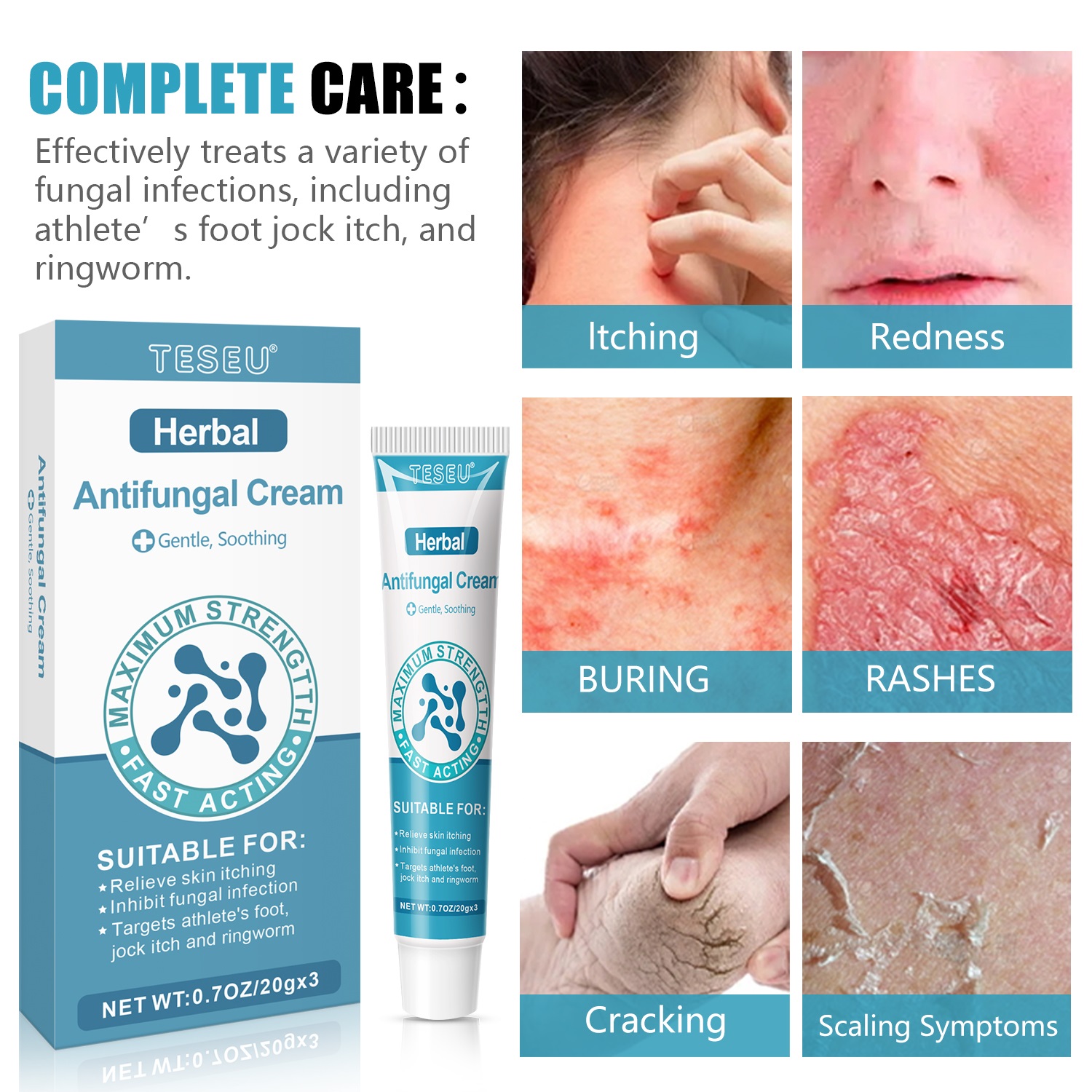Infographic of six fungal skin issues treated by TESEU antifungal cream