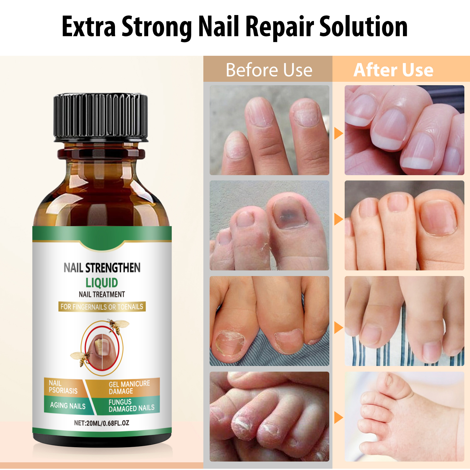 TESEU Extra-Strength Fungal Nail Liquid to Restore Healthy Nails - Image 6