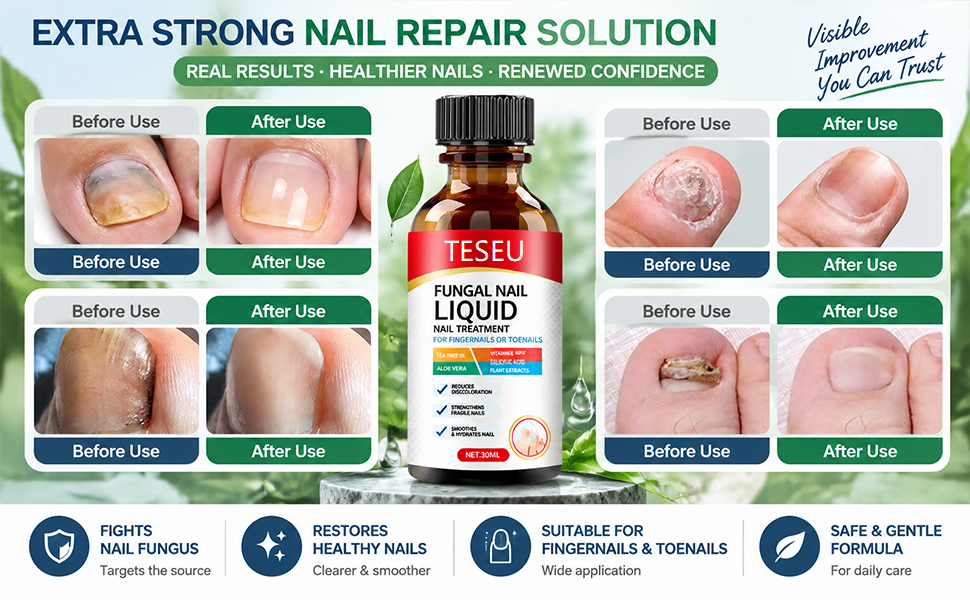 Fungal Nail Treatment