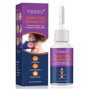 TESEU Skin Tag Wart Removal w/ Gentle Botanical Extracts