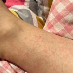 TESEU Antifungal Cream Strengthens Skin Natural Barrier, 3.53oz photo review