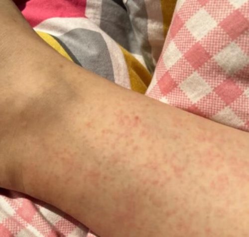 Click to view full screen TESEU Antifungal Cream Strengthens Skin Natural Barrier, 3.53oz photo review