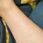 TESEU Antifungal Cream Strengthens Skin Natural Barrier, 3.53oz photo review