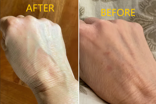 TESEU Antifungal Cream w/ Tea Tree Oil Fast Relief, 3.53oz photo review