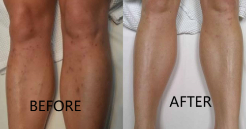 Click to view full screen TESEU Antifungal Cream Strengthens Skin Natural Barrier, 3.53oz photo review