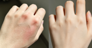 Click to view full screen TESEU Antifungal Cream for Itch / Ringworm Relief, 2 Pack photo review