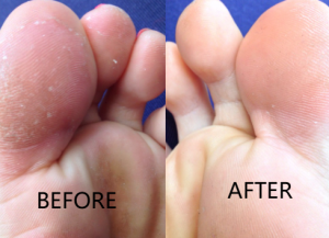Click to view full screen TESEU Antifungal Cream for Itch / Ringworm Relief, 2 Pack photo review