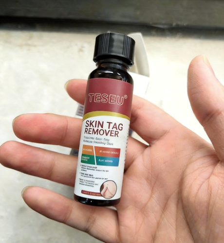 TESEU Wart Removal Skin Tag Removal Kit w/ Plant Extracts photo review