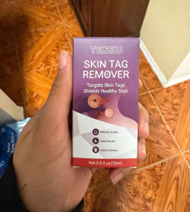 TESEU Wart Removal Gentle Effective for Skin Tag Verruca Corn photo review