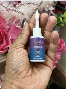 TESEU Skin Tag Wart Removal Liquid w/ Strong Formula photo review