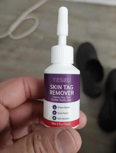 TESEU Wart Removal Gentle Effective for Skin Tag Verruca Corn photo review