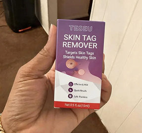 Click to view full screen TESEU Wart Removal Gentle Effective for Skin Tag Verruca Corn photo review
