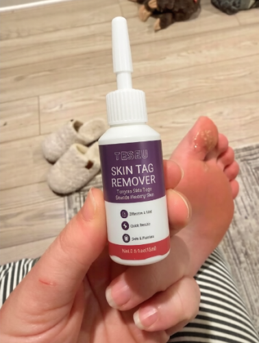Click to view full screen TESEU Wart Removal Gentle Effective for Skin Tag Verruca Corn photo review