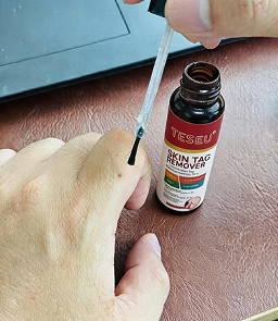 Click to view full screen TESEU Gentle Skin Tag & Wart Removal with Botanicals photo review