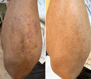 Click to view full screen cures my arm fungus