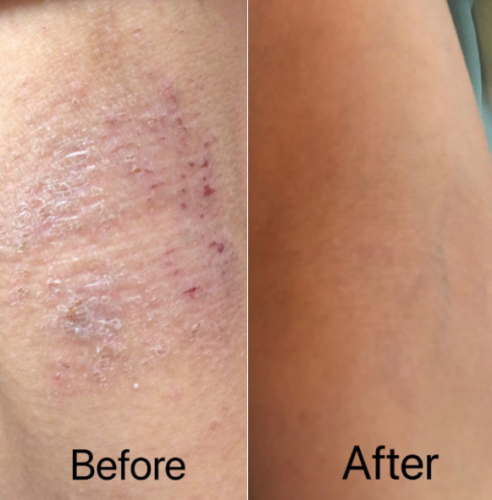 Click to view full screen antifungal
