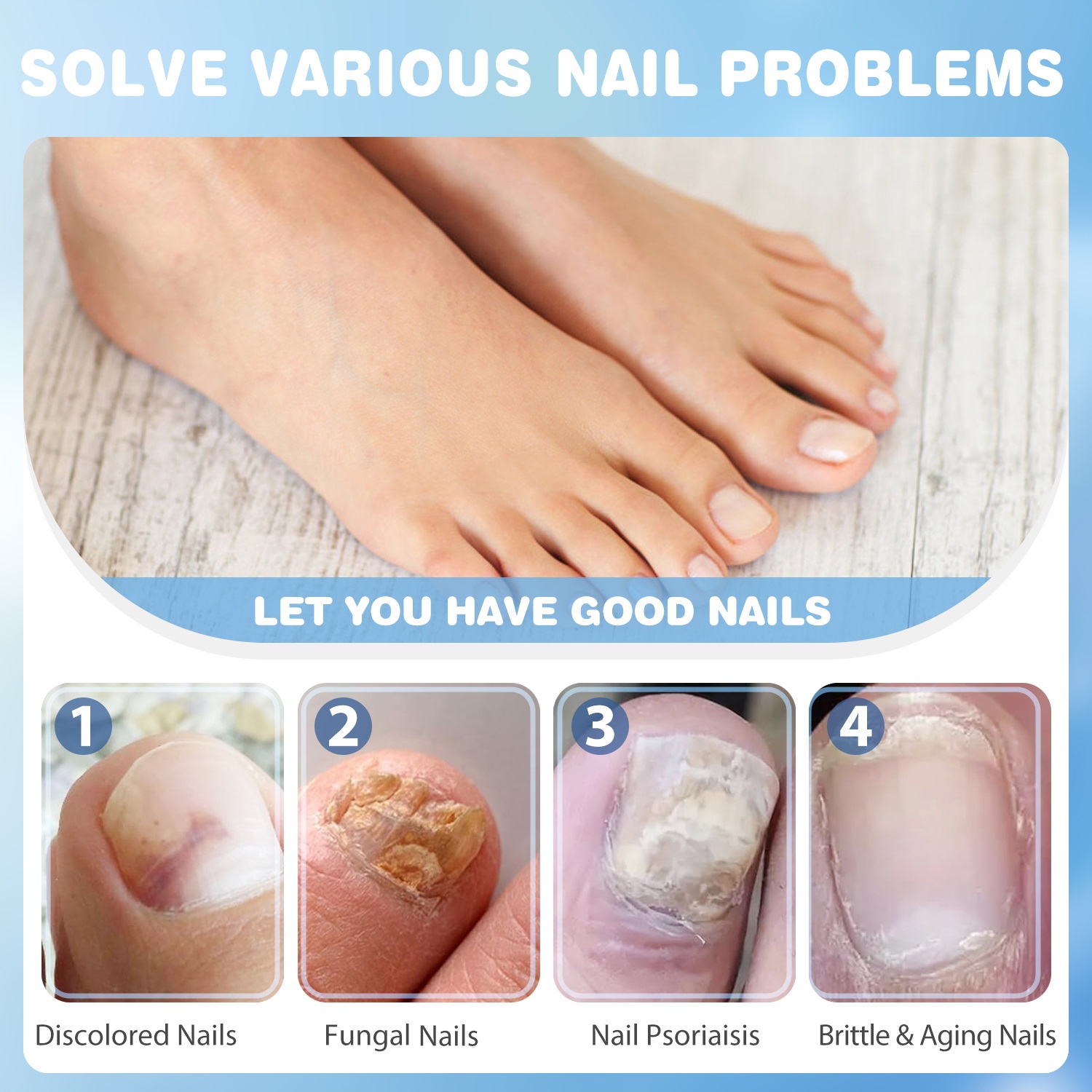 Which daily hygiene habits prevent toenail fungus from coming back?