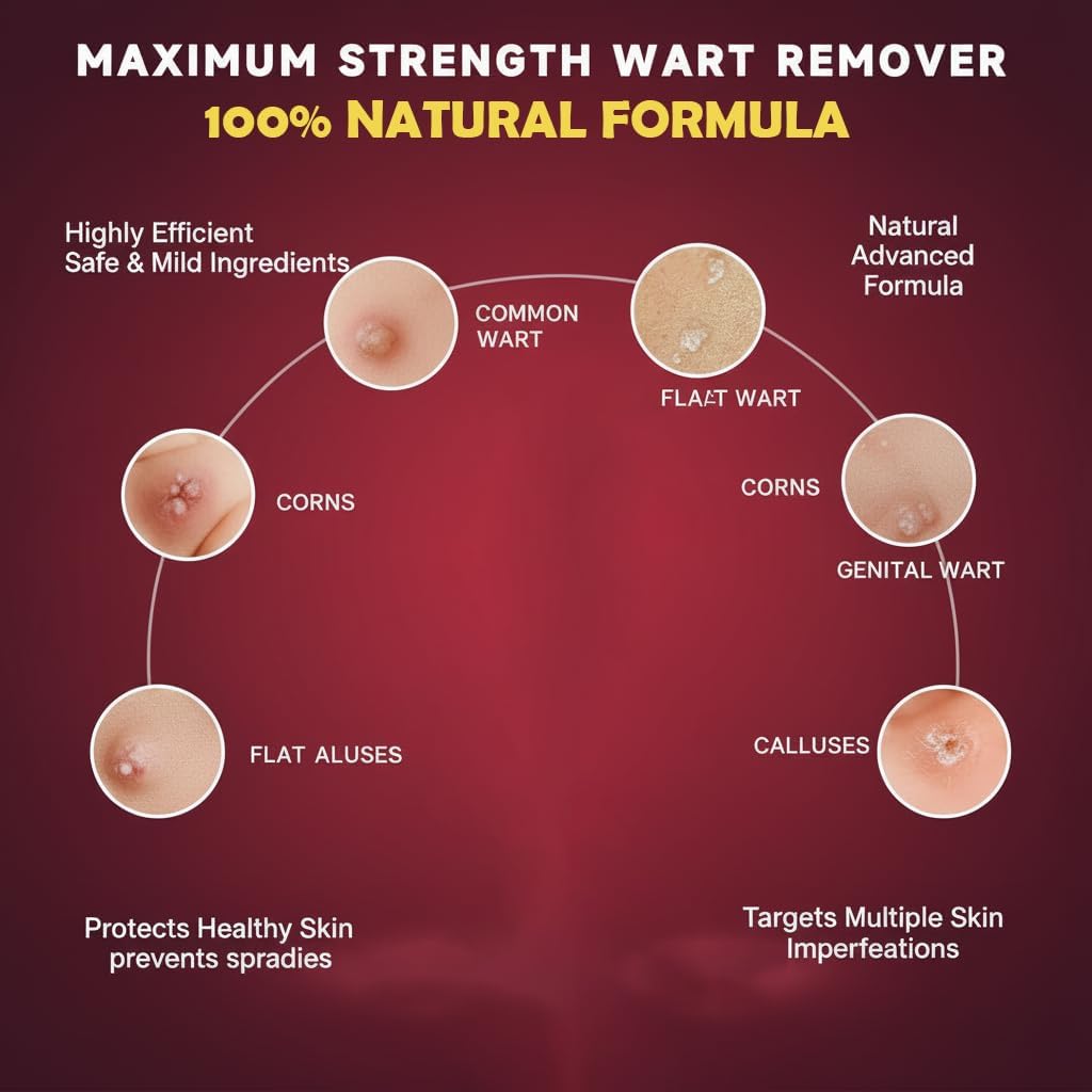 How long does it take for a treated wart to turn black and fall off?